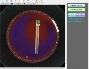90mm Etest Blood Plate with Image Enhancement
